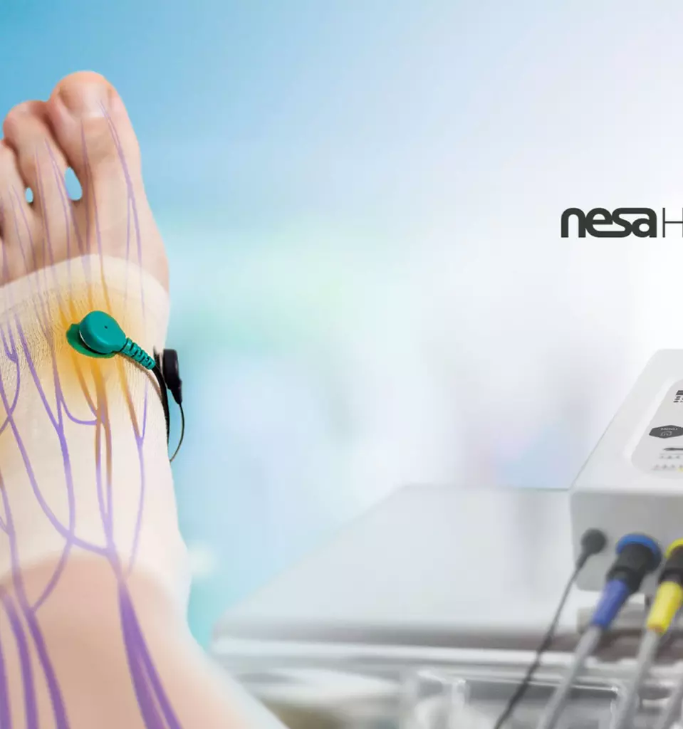 Tratamiento de neuromodulación no invasiva NESA